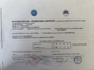 Hajdi Displasia